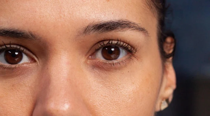 Puffy Eyes: The Causes & Best Tips How to Get Rid of Puffy Eyes