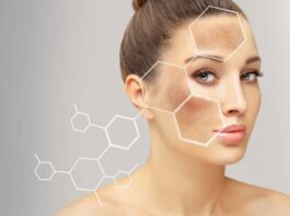 Best Products for Treating Hyperpigmentation