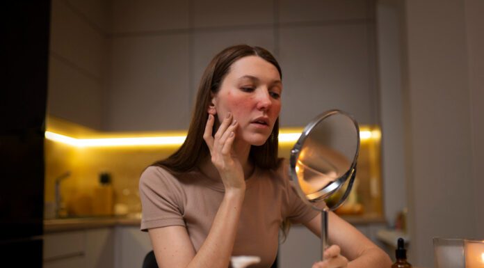 Skincare for Redness: Natural Remedies for Flawless Skin Best product for skincare for Redness